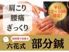 ★平日12時~16時限定★【部分鍼】通常6,000円→初回4,000円
