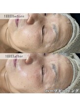 ネイルズビー 別邸(Nail's be)/年齢が出やすい目元にも１回で◎