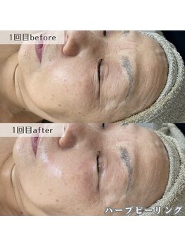 ネイルズビー 別邸(Nail's be)/年齢が出やすい目元にも１回で◎