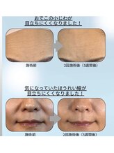 ココサロン(Coco Salon)/美容液導入