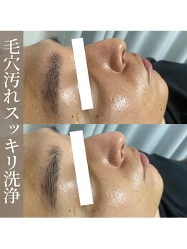 ブリリオプラス 四条烏丸店(Brillio plus)の写真/【メンズご予約可能◎】毛穴ケアでスッキリ清潔感のある印象へ