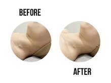 イードット(E.)/お顔エステでスッキリ！