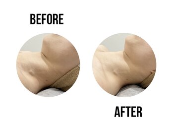 イードット(E.)/お顔エステでスッキリ!