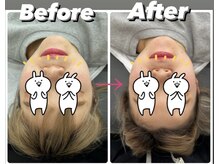 リリィズネイル(LILY's nail)の雰囲気（骨から矯正して自分史上最小小顔に♪6,000 1ヶ月5,000 初回4,000）