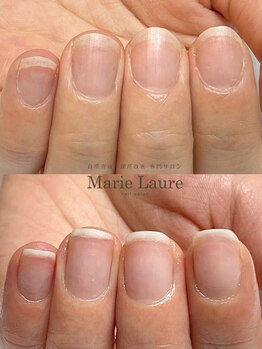 マリーロール 梅田店(Marie Laure)/自爪育成/深爪矯正/ネイルケア