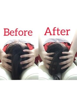 蕨整体院/自律神経/頭痛/睡眠/頭蓋強制