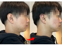育肌美研 自由が丘サロン/たるみ・引き上げ効果も