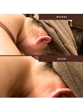 チャンティック(Cantik)/うなじケア