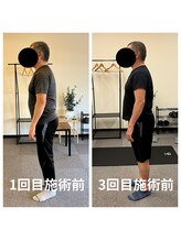 熊本カワル整体 JR上熊本駅院/重心の位置