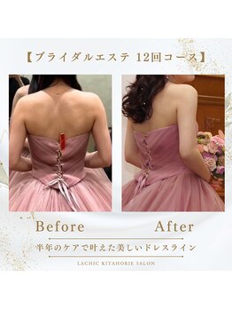 ラシク 北堀江店(LACHIC)/ブライダルエステ