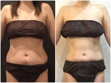 美容整体ウェリナ あま甚目寺院/小顔矯正/骨盤矯正/美脚サロン