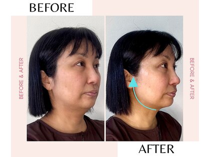 キューサッポロ(SalonQSapporo)の写真