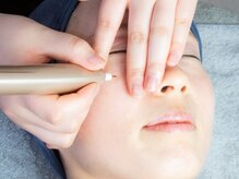 シミケアはダウンタイムなし! 低刺激なのに、しっかり結果。