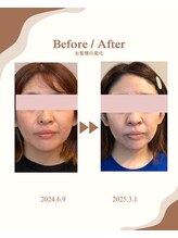 アオダモ(aodamo)/