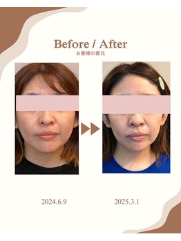 アオダモ(aodamo)/