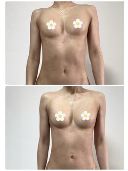 ベルフェム(Bellefemme)/