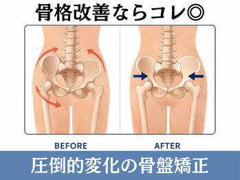 サンティエールの写真/【骨盤の歪み・広がり・下半身痩せ】骨盤から整えて美姿勢・巻き肩改善・脚スリム！