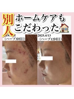 ホワイトアクア 天王寺本店(WHITE AQUA)/