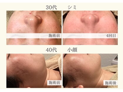 サロン リア(Salon Li’a)の写真