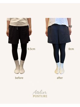 アトリエ ポスチュア(Atelier Posture)の写真/O脚を根本から整えたい方へ