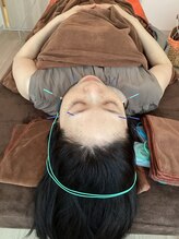 ハリファ鍼灸院 横浜関内院(HariFa鍼灸院)/美容施術