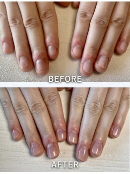 ポメロ(POMELO)/即日で見た目が変わる！感動体験