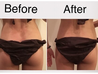 肌質改善ラボの写真