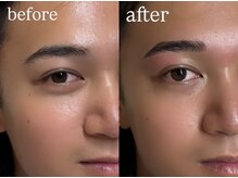 エン(en.)の雰囲気（プロの手で、なんか垢抜けたねって言われる眉に。）