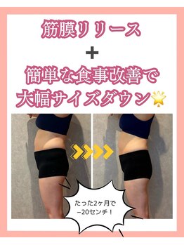 エミィシア(Emisia)/