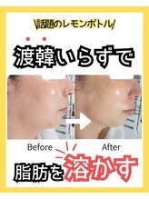 グラシア 宇土店(gracia) 話題のレ モンボトル