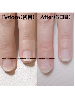 スマイルニコ(smile nico)/