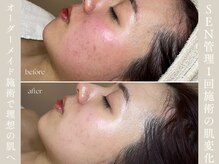 エクラムサロン 代官山(eclam salon)