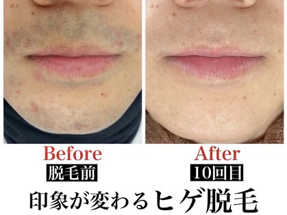 ツバキ(TSUBAKI)の写真