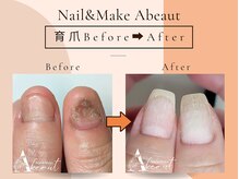 ネイルアンドメイク アビュート(Nail Make Abeaut)の雰囲気（富山では数少ない大人気の育爪メニュー★深爪・噛み爪矯正にも。）