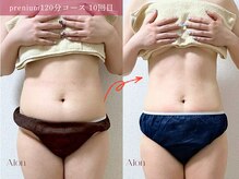 アイオン(Aion)/無理のない痩身エステ
