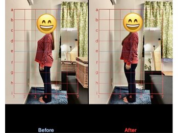 みふく整体院/施術前と後で身体の状態を比較