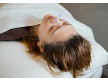 デルタエヌピー63+(δnp63+)/お客様施術例【小顔/薬院/福岡】