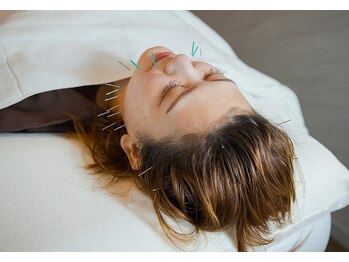 デルタエヌピー63+(δnp63+)/お客様施術例【小顔/薬院/福岡】