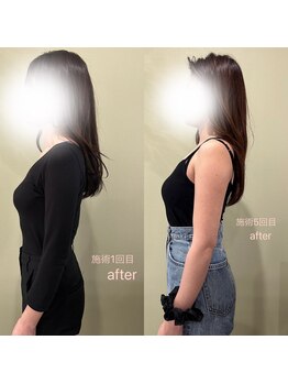 アヴェラーレ(avverare)/話題のバストアップ★