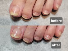 キャットケー ネイル(CAT.K Nail)/【foot】care