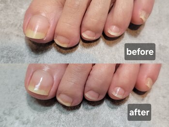 キャットケー ネイル(CAT.K Nail)/【foot】care