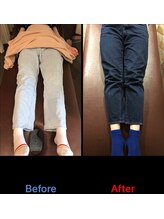 弁慶はりきゅう整体院 西大津院/施術ビフォーアフター