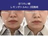 話題のレモンボトル脂肪分解液導入！！韓国発！ 小顔リフト♪1CC～