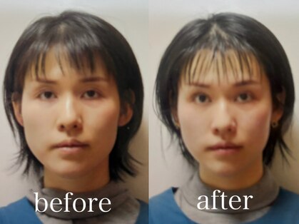 小顔矯正アンドフェイシャルサロン アンベリール(embellir)の写真