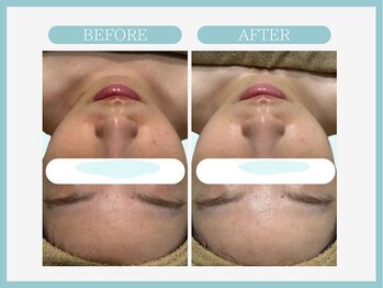 スリムライン 仙台店(The Slim Line)/before→after