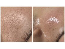 ディーロータス(D-lotus)の雰囲気（人気のハーブピーリング／WAX脱毛／最新光脱毛/メンズOK）