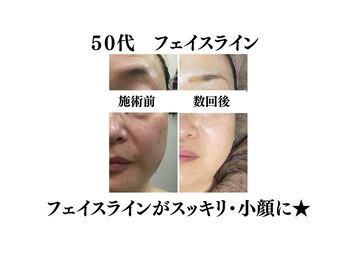 わ心美/ビフォーアフター