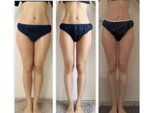 フェムプリュ(femplus)