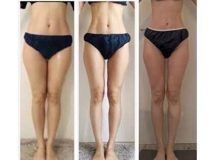 フェムプリュ(femplus)の写真