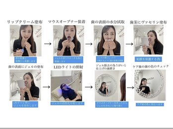 ホワイトニングショップ 茨木店/【照射中もリラックス】